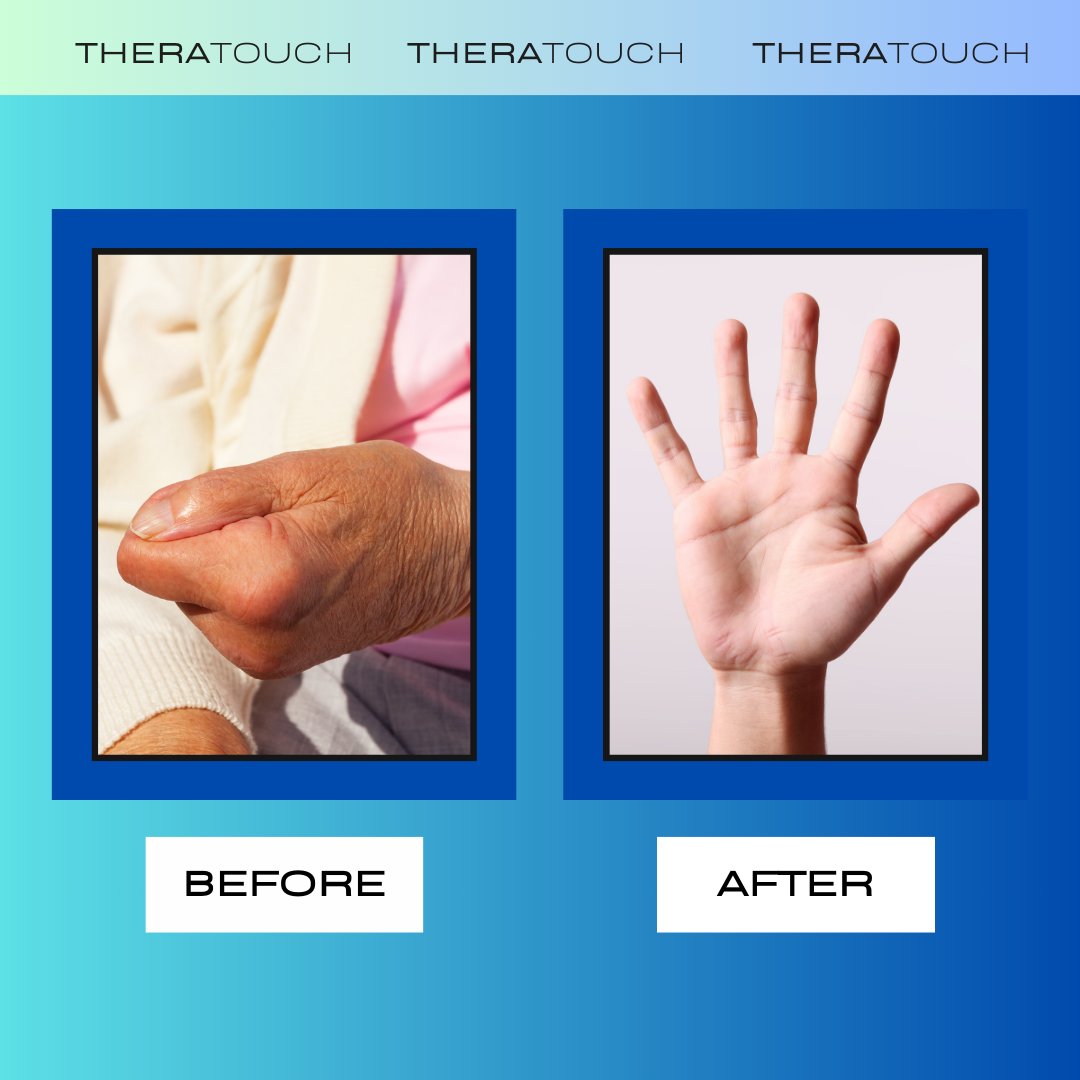 Thera Touch Rehabilitation Glove